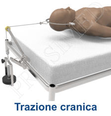 Trazione cranica